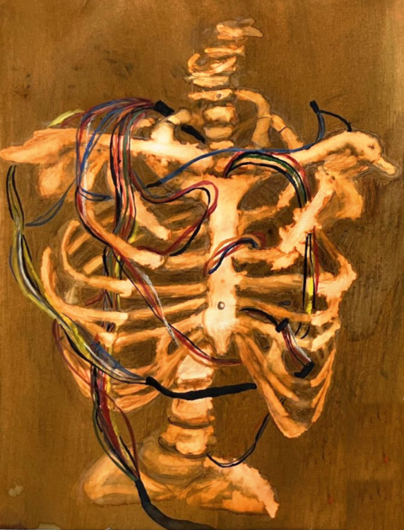 Painting of a ribcage with coloured wires threaded through it like nerves